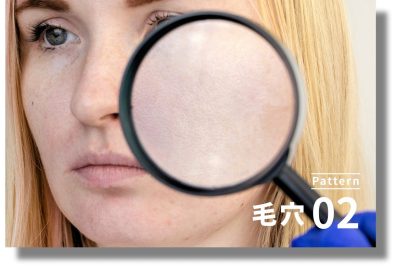 キュアジェット | ニキビ・ニキビ跡