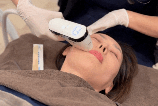 オーダーメイドHIFU（10トリプル） | たるみ・リフトアップ