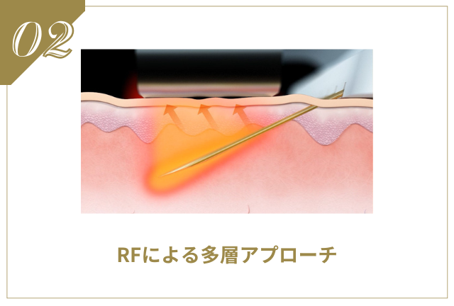 ブレッシング | たるみ・リフトアップ