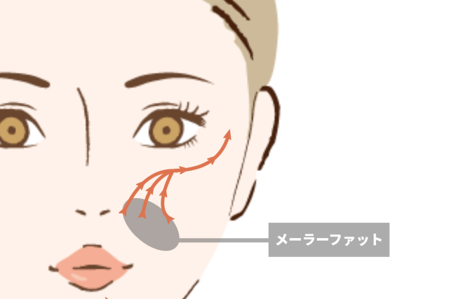 坂東式糸リフト | たるみ・リフトアップ