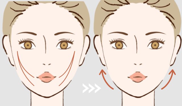 坂東式糸リフト | たるみ・リフトアップ