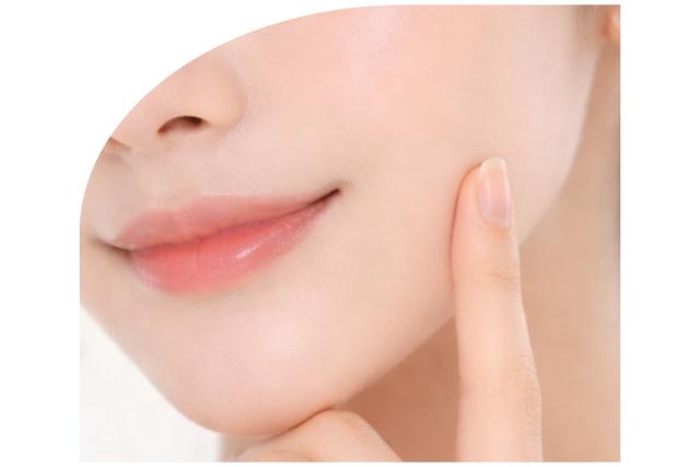 中顔面短縮３Dチークリフト(バーティカルリフト) | たるみ・リフトアップ