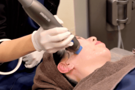 テンサーマ（10THERMA） | たるみ・リフトアップ