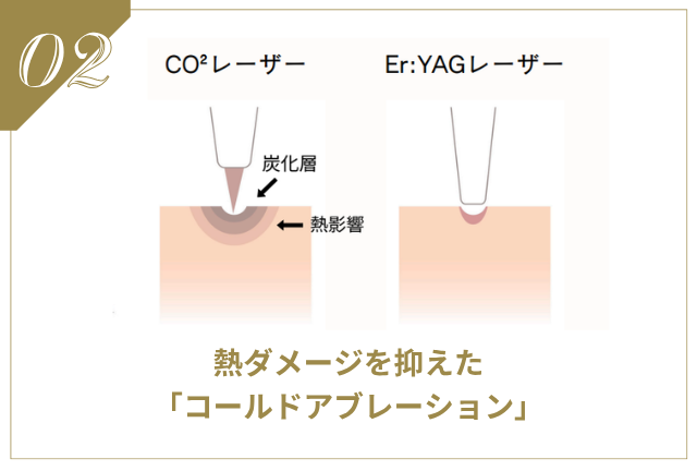 クリスタ(Er:YAG) | ニキビ・ニキビ跡